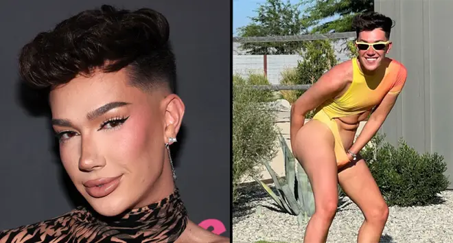 James Charles Reveals Botox and Lip Fillers Amid Plastic Surgery Speculation