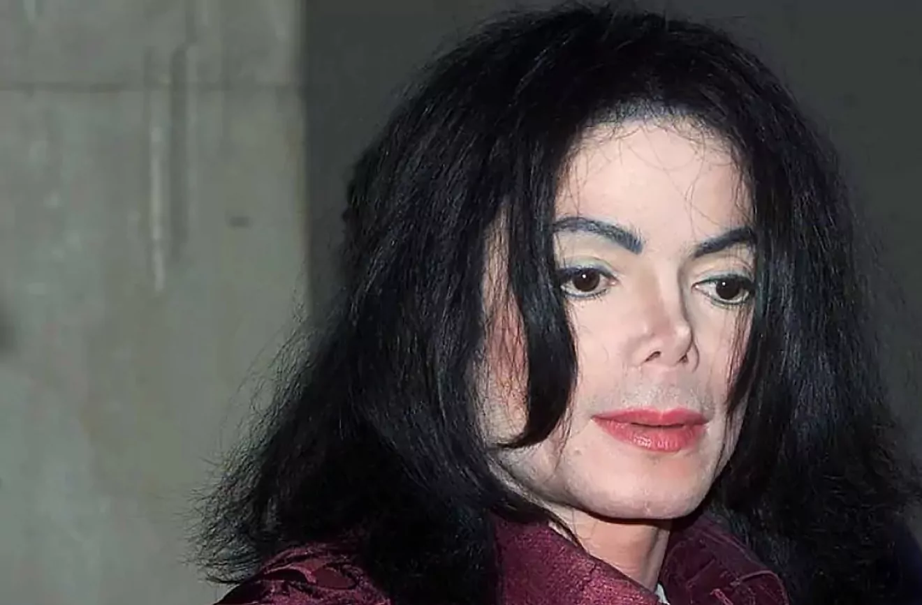 Michael Jackson’s Rhinoplasty: The Truth Behind His Plastic Surgery Journey