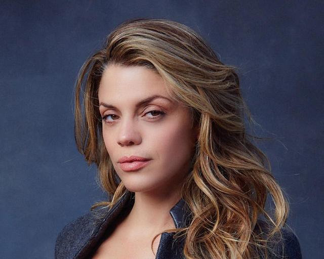 Vanessa Ferlito’s Speculated Plastic Surgery: Fillers and Rhinoplasty Rumors