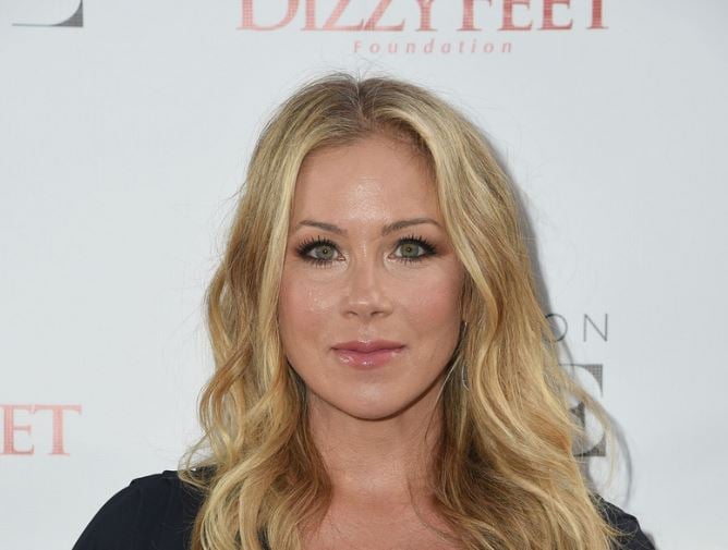 Christina Applegate’s Journey: Rumored Plastic Surgery and Breast Augmentation