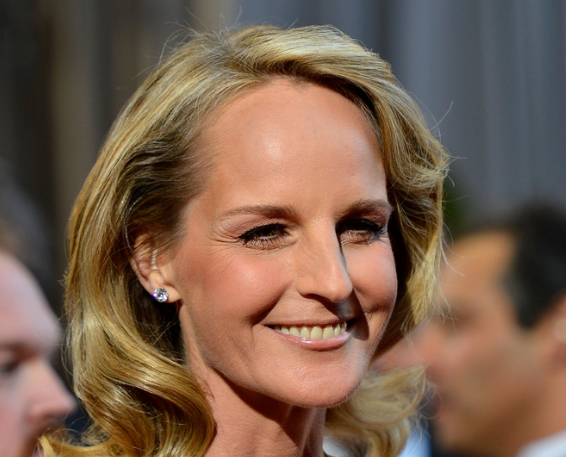 Helen Hunt’s Rumored Plastic Surgery: Facelift and Neck Lift Speculations