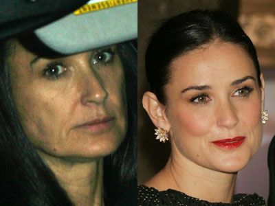 Demi Moore’s Plastic Surgery Speculations: Breast Augmentation and More