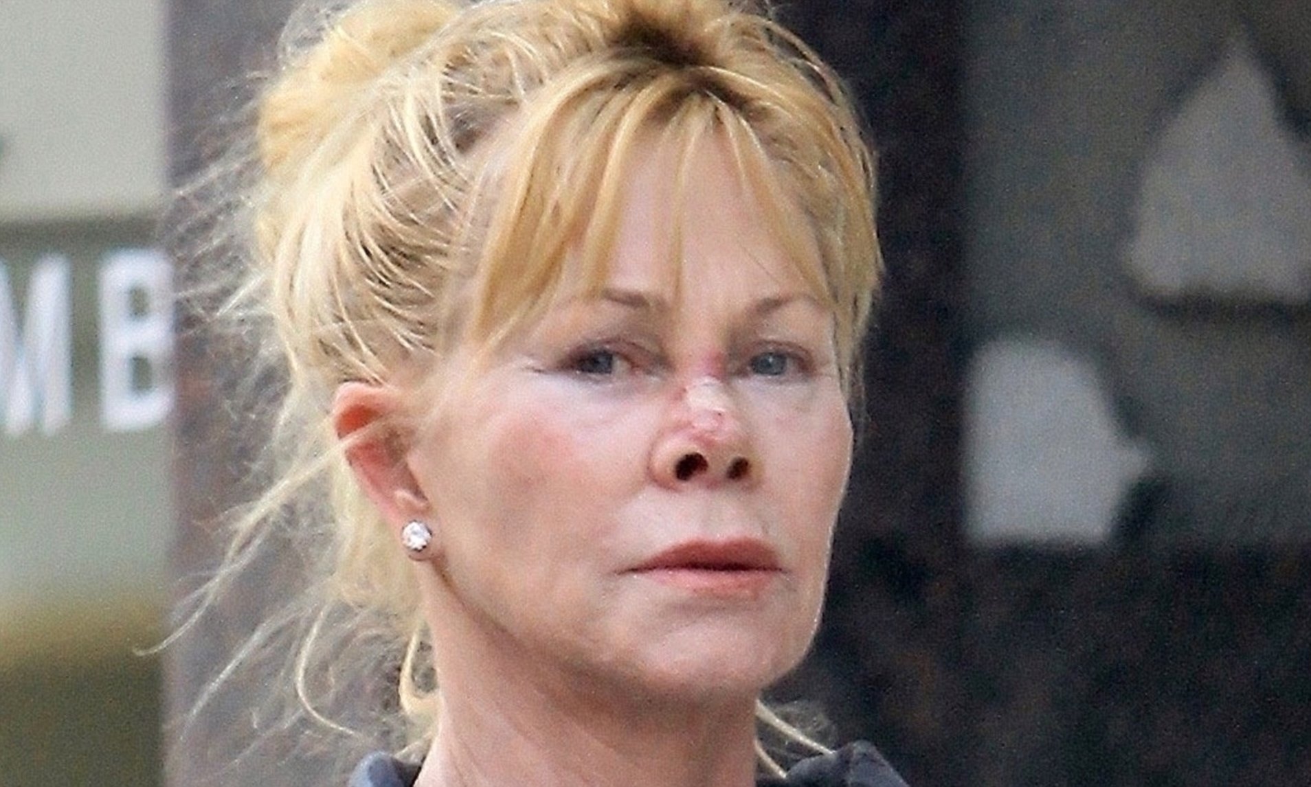 Melanie Griffith’s Journey: From Facelifts to Embracing Natural Beauty